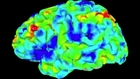 Resting-state functional MRI data