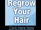Provillus Hair Regrowth Treatment