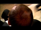 Nanogen Hair Loss Product TV Advert for Men