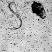 white blood cells attack a parasitic worm