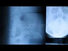 Xray 8 Pack FREE Stock Video DOWNLOAD