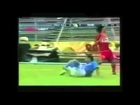 Accidental Sports Knockouts and Injuries Pt.1